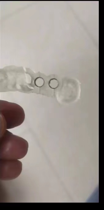 Resin Dental 3D Printer Planti - 3D Printing House Machine recension och pris